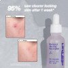Очищаючий рідкий пілінг Dermalogica Breakout Clearing Liquid Peel 
