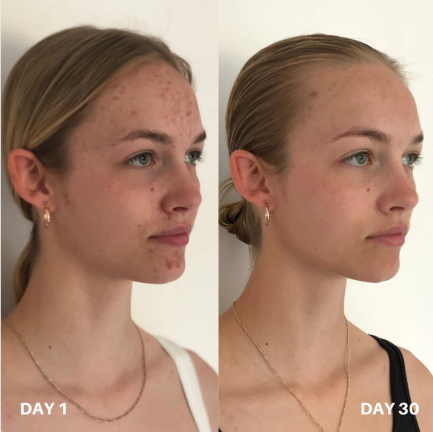Clinisoothe+ Skin Purifier